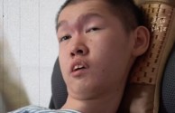 抖音上的月月是什么罕见病的简单介绍