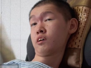 抖音上的月月是什么罕见病的简单介绍
