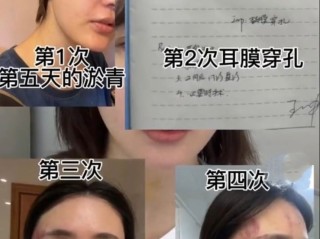 女主播虚构被家暴,直播卖惨求刷礼物,3个月捞金700多万,直播被女主播家暴怎么办