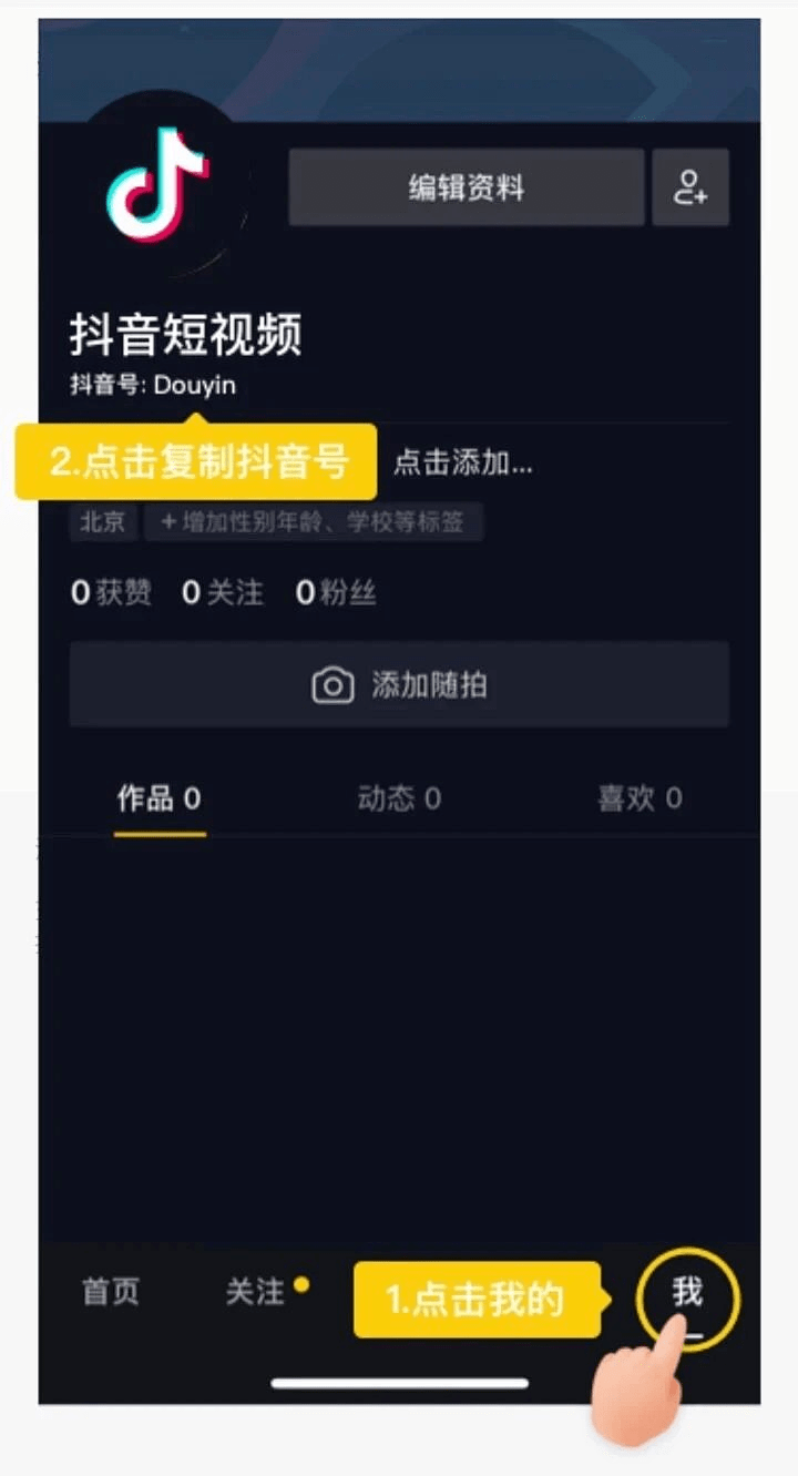 包含抖音充值入口的词条